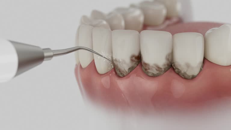 Trusted Teeth Cleaning And Checkup service in Robstown, TX - Dentist Open Now